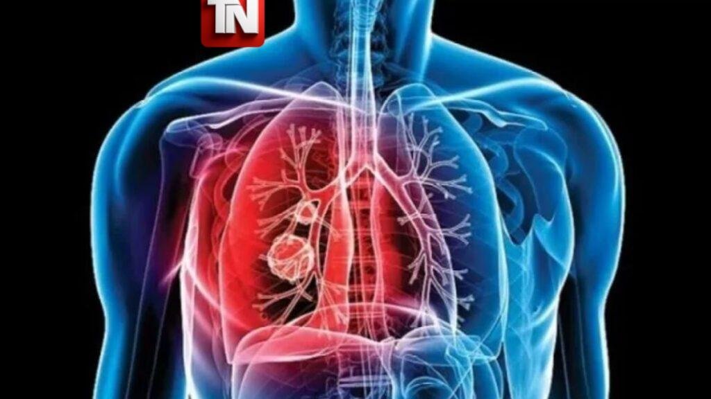 Confirman caso de tuberculosis en centro de detención de inmigrantes en Colorado; autoridades activan protocolo sanitario